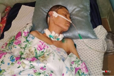 В одной из деревень Башкортостана избили жительницу Челябинской области: пострадавшая в коме